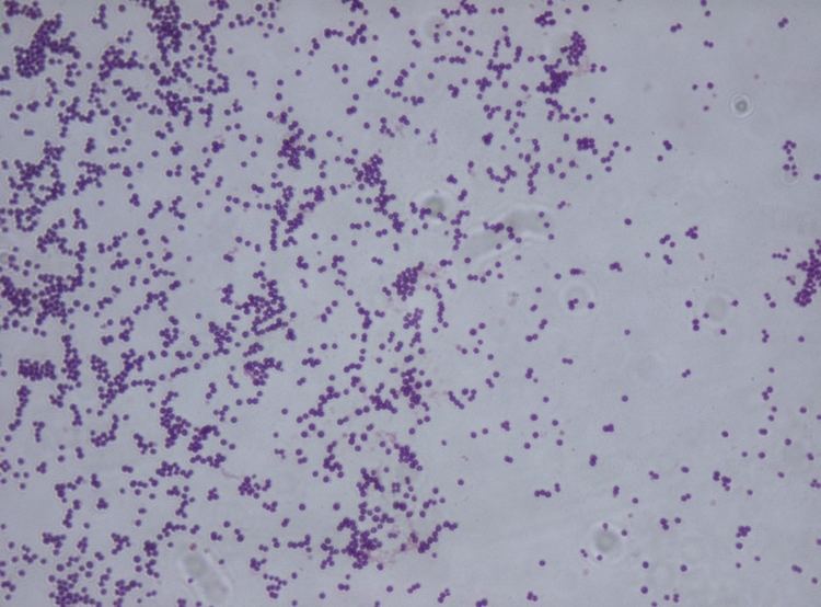 Staphylococcus saprophyticus gram stain