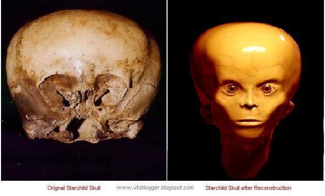 Starchild skull 1000 images about Starchild Skull on Pinterest The skulls Childs