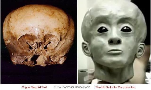 Starchild skull Extraterrestrial DNA Found In 900 Year Old Starchild Skull UFO