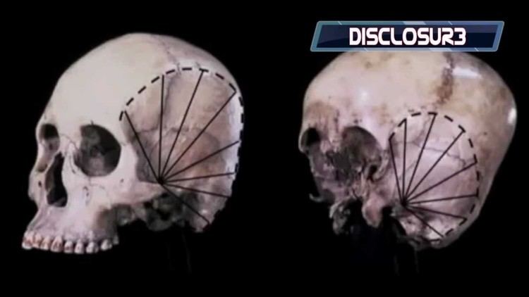 Starchild skull Starchild Skull The SHOCKING DNA Results Are InWATCH THIS HD