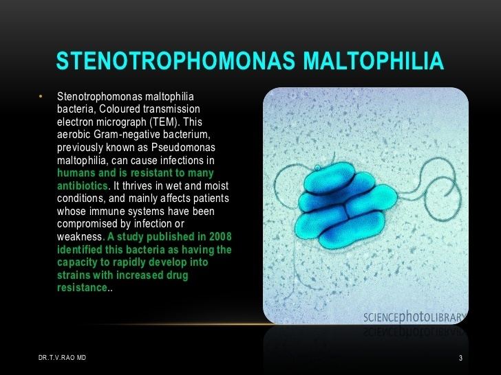Stenotrophomonas httpsimageslidesharecdncomstenotrophomonasma