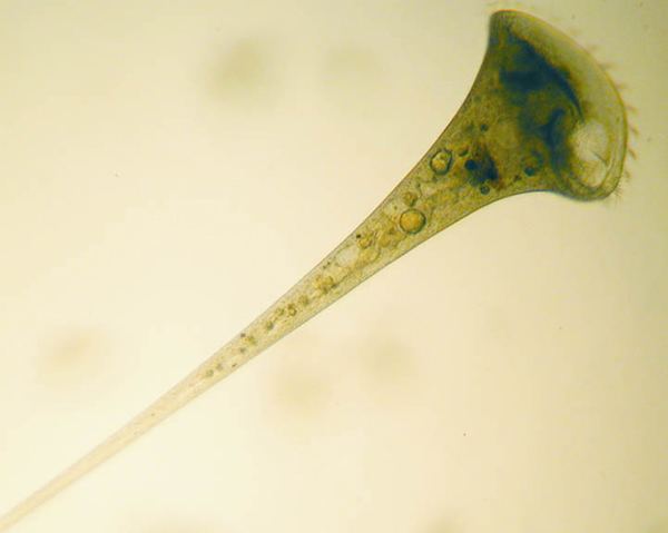Stentor (ciliate) cfbunheduphycokeyChoicesAmoebaeFlagellatesC