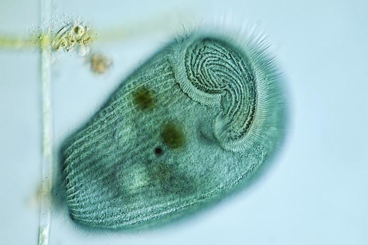Stentor coeruleus Stentor Coeruleus Protozoan Micrograph Photograph by Frank Fox