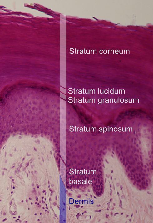 Stratum spinosum