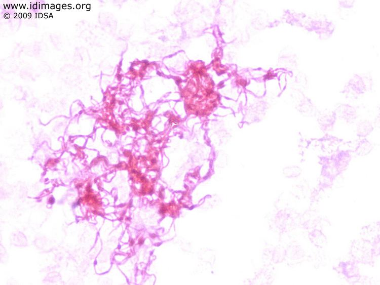 Streptobacillus moniliformis Streptobacillus Images Partners Infectious Disease Images