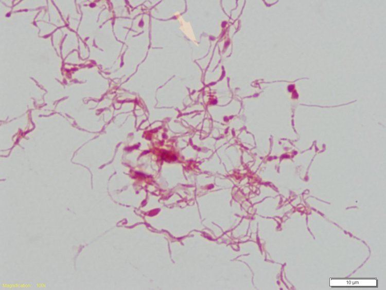 Streptobacillus moniliformis A treasured pet a fever and a rash infectionNet