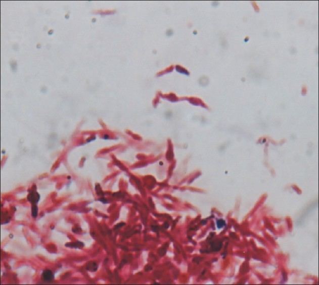 Streptobacillus moniliformis Isolation of Streptobacillus moniliformis from the blood of a child