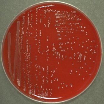 Streptococcus bovis atlassundkudkmicroatlasfoodbacteriaStreptoc