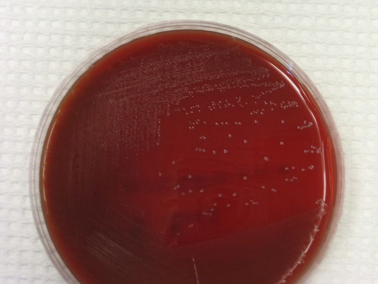 Streptococcus bovis Streptococcus bovis Virtual Lab Microbiology