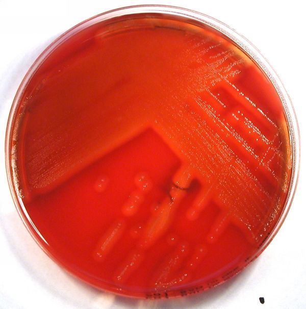 Streptococcus equisimilis wwwbakteriologieatlasdeBilderStreptococcusequ