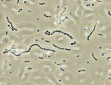 Streptococcus iniae httpsuploadwikimediaorgwikipediacommonsthu