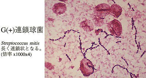 Streptococcus mitior httpssmediacacheak0pinimgcom736xbb8c58