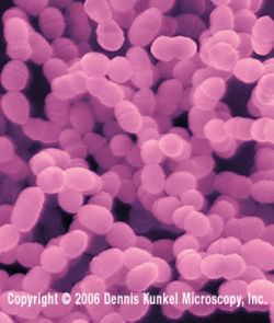 Streptococcus mutans Streptococcus mutans MicrobeWiki