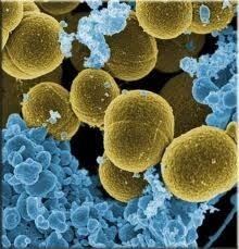 Streptococcus oralis httpsmicrobewikikenyoneduimages22aStrepto