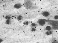 Streptococcus pseudopneumoniae jcmasmorgcontent443923F1smallgif