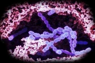 Streptococcus salivarius Streptococcus salivarius Aurametrix