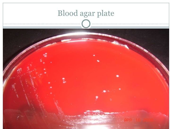 Streptococcus salivarius Strep Salivarius