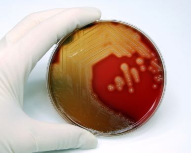 Streptococcus uberis wwwhygieialabscomstrepbloodagarjpg