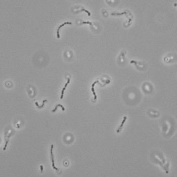 Streptococcus zooepidemicus zooepidemicus