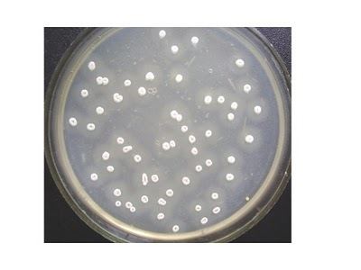 Streptomyces aureofaciens Streptomyces aureofaciens Enfo