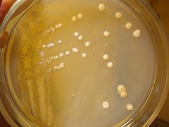 Streptomyces gardneri httpsuploadwikimediaorgwikipediacommonsthu
