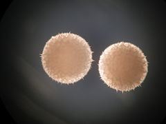 Streptomyces hygroscopicus httpsuploadwikimediaorgwikipediacommonsthu
