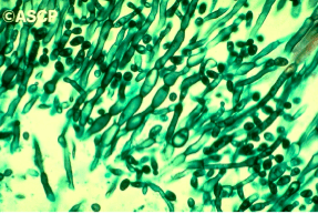 Streptomyces nodosus Introduction to mycology at University of Oklahoma Health Sciences