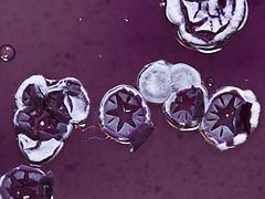 Streptomyces olivaceus httpsuploadwikimediaorgwikipediacommonsthu