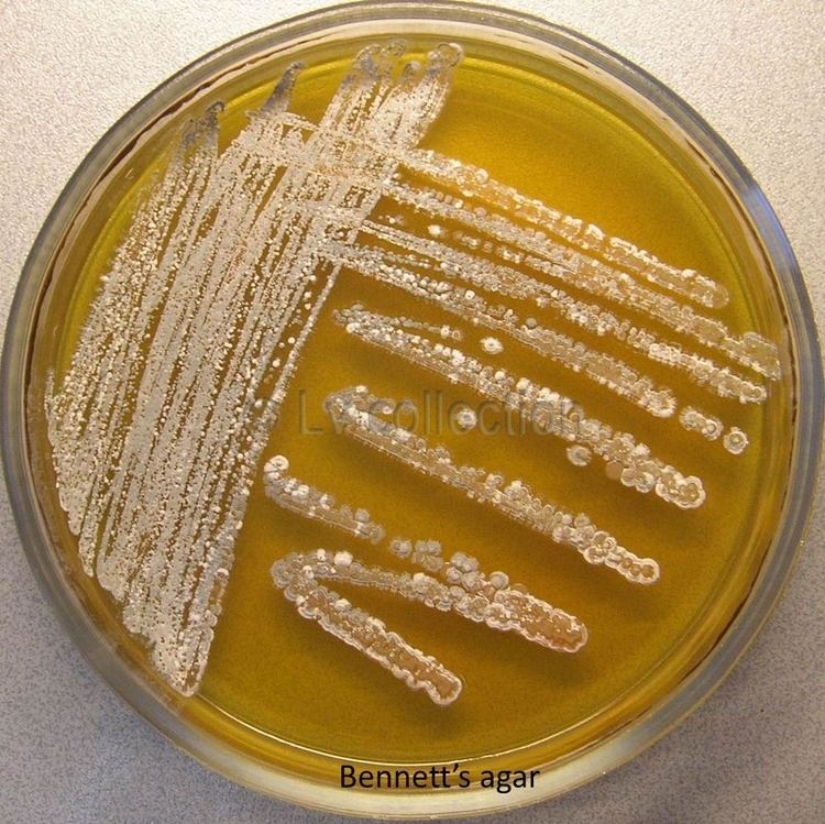 Streptomyces peucetius Lv 77 Streptomyces peucetius subsp caesius