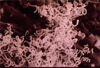 Streptomyces scabies Factsheet Streptomyces scabies