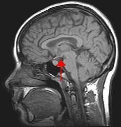 Subfields of psychology