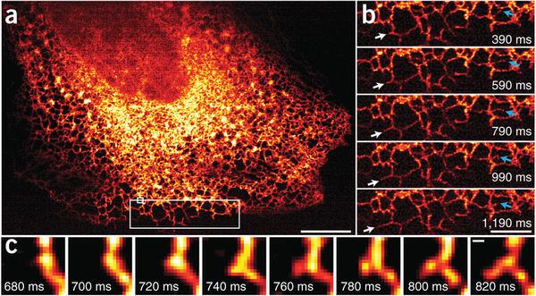 Super-resolution imaging Instant superresolution imaging in live cells and embryos via
