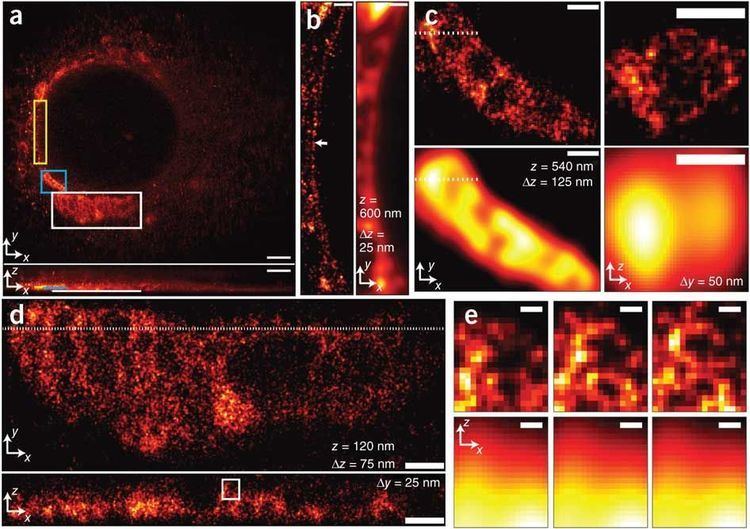 Super-resolution imaging 3D superresolution imaging of an endoplasmic reticulum network
