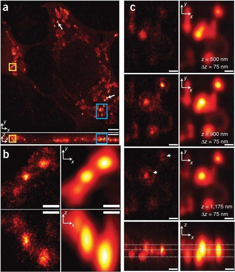 Super-resolution imaging 3D superresolution imaging of a mitochondrial network Confined