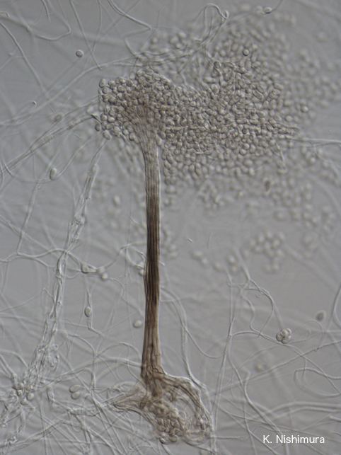 Synnema Scedosporium apiospermum microscopysynnema