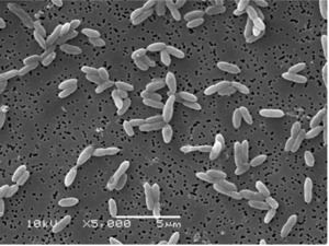 Syntrophobacter wolinii microbewikikenyoneduimagesthumb99eSfumarox
