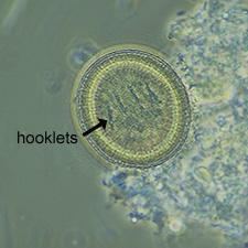 Taenia-like egg from fecal floatation, hooklet structures are pointed out