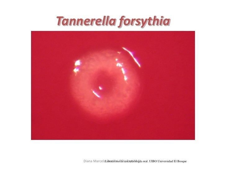 Tannerella forsythia Microorganismos anaerobios Diana Marcela Castillo 2012