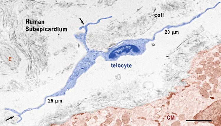 Telocyte