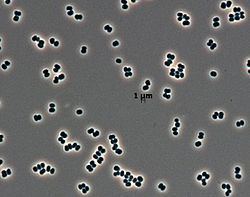 Tersicoccus phoenicis httpsuploadwikimediaorgwikipediacommonsthu