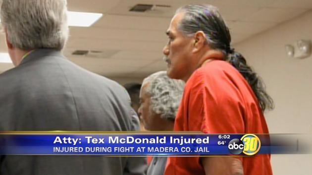 Tex McDonald Chukchansi Gold Resort and Casinos Tex McDonald suffers broken jaw