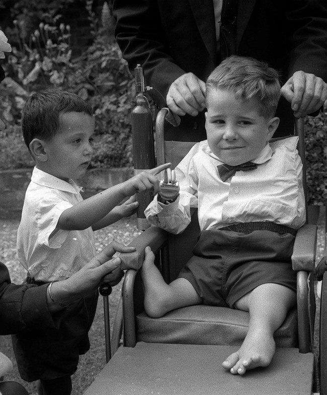 On the right is a young boy smiling shyly in his wheelchair with a power tank, affected by Thalidomide having malformed legs and an artificial right hand and he's with a man in the background leaning on the wheelchair while on the left is a young boy standing and touching the artificial finger with a hand of someone beside him with a gold bangle. The young boy on the right is wearing a collared long sleeve with a bow tie and a pair of short pants and the man behind him is wearing a black coat while the young boy on the left is wearing a collared polo shirt with a pair of short pants.