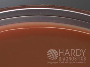 Thayer-Martin agar httpscataloghardydiagnosticscomcpprodConte