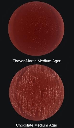 Thayer-Martin agar Neisseria gonorrhoeae GramNegative Bacteria Pathogen Profile