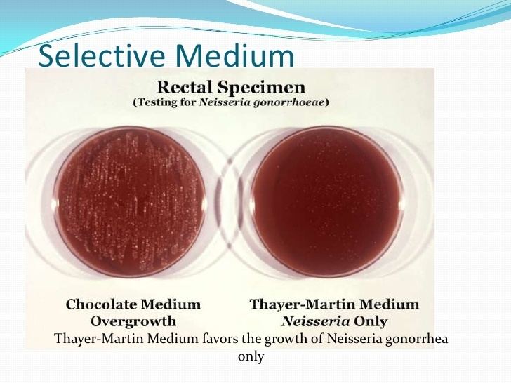 Thayer-Martin agar Identification And Differentiation Of Microorganisms