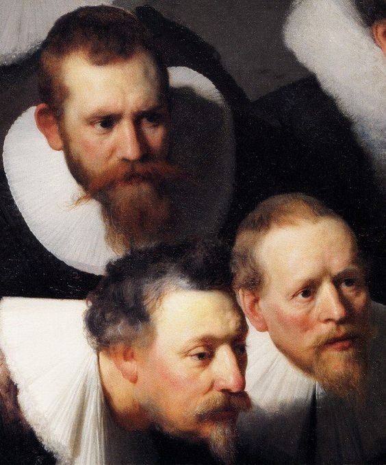 The Anatomy Lesson of Dr. Nicolaes Tulp Artwork by Rembrandt van Rijn The Anatomy Lesson of Dr Nicolaes