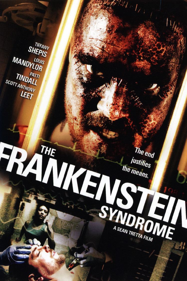 The Frankenstein Syndrome wwwgstaticcomtvthumbdvdboxart8711096p871109