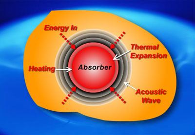 Thermoacoustic imaging