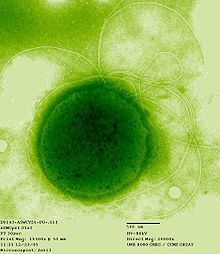 Thermococcus gammatolerans httpsuploadwikimediaorgwikipediacommonsthu