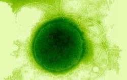 Thermococcus litoralis httpswwwecuredcuimages22cThermococcuslit